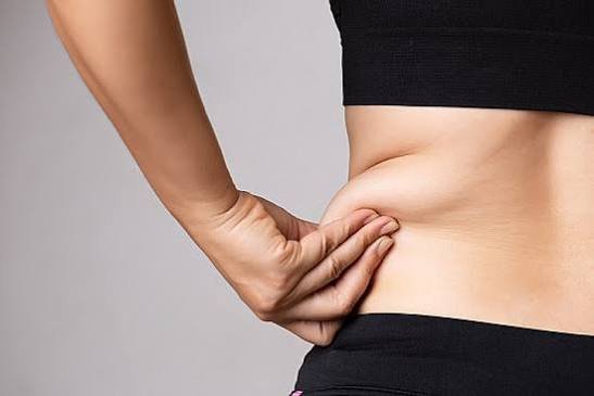 FAT FREEZING/CRYOLIPOLYSIS