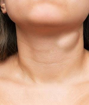 HEAD, NECK AND BODY