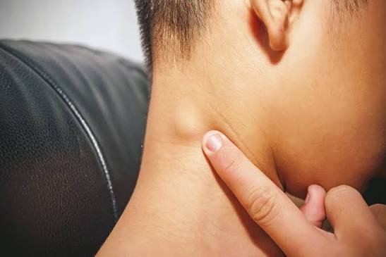 HEAD & NECK LUMPS